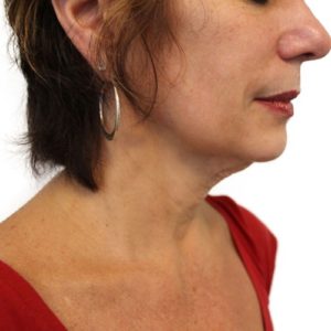 woman's lower face
